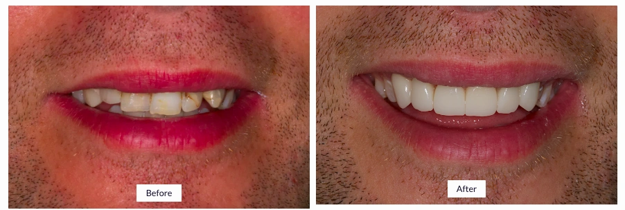 Lakewood Dental Associates