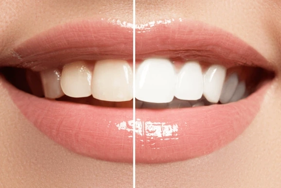Dr. Nancy Bishay & Associates Family Dental Office