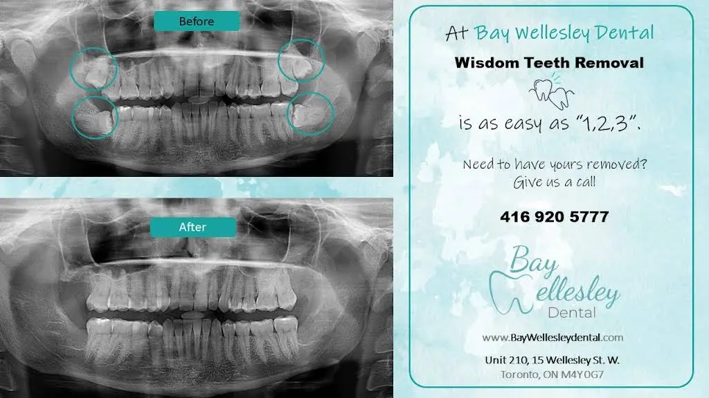 Bay Wellesley Dental