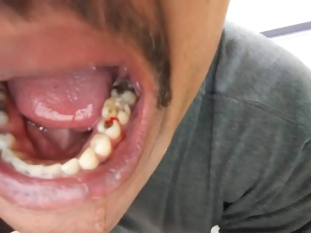 Locust Dental Group