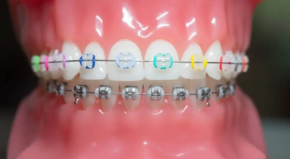 Casellas Orthodontics