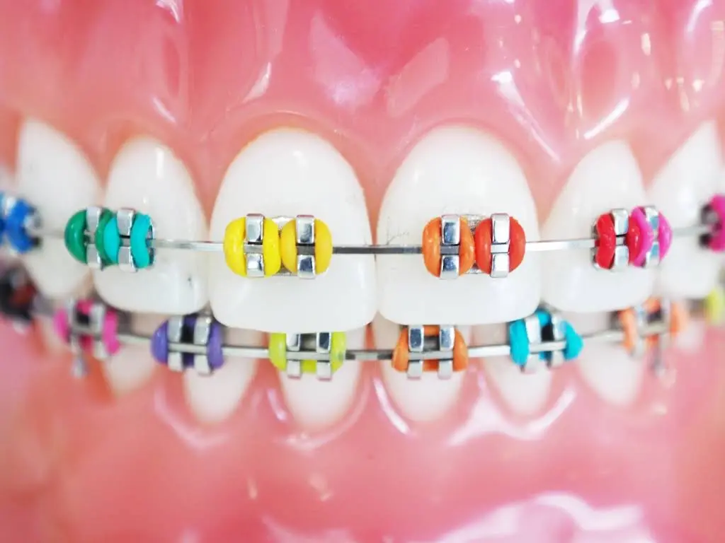 Casellas Orthodontics