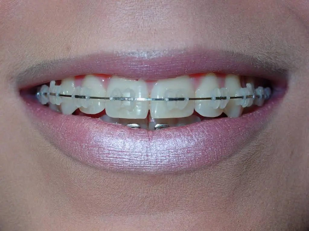 Cleveland Smile Stylers