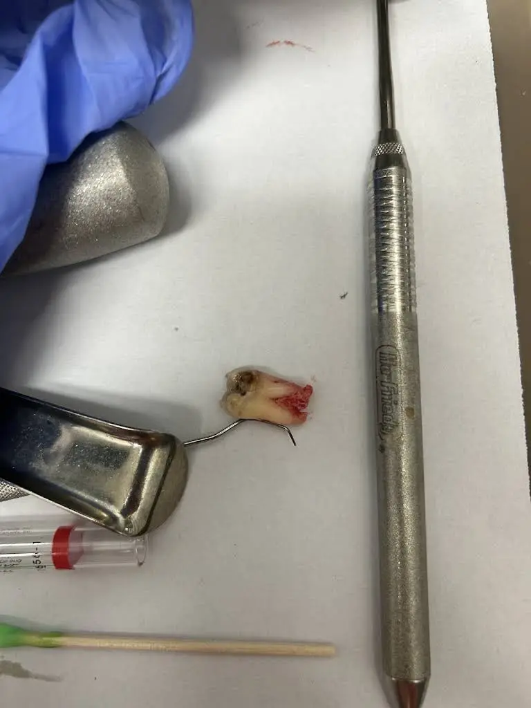 The Tooth Corner
