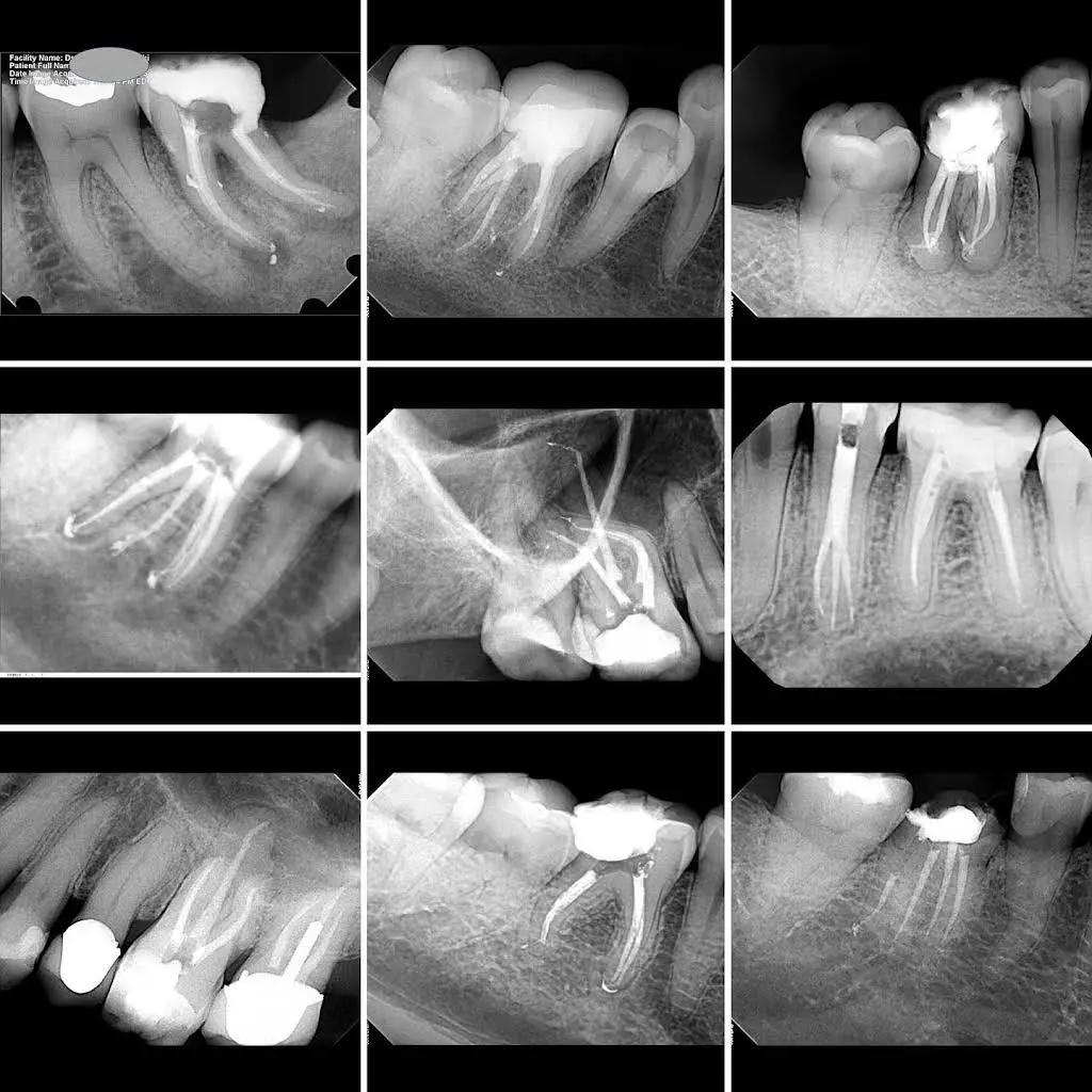 Endodontics on Don Mills