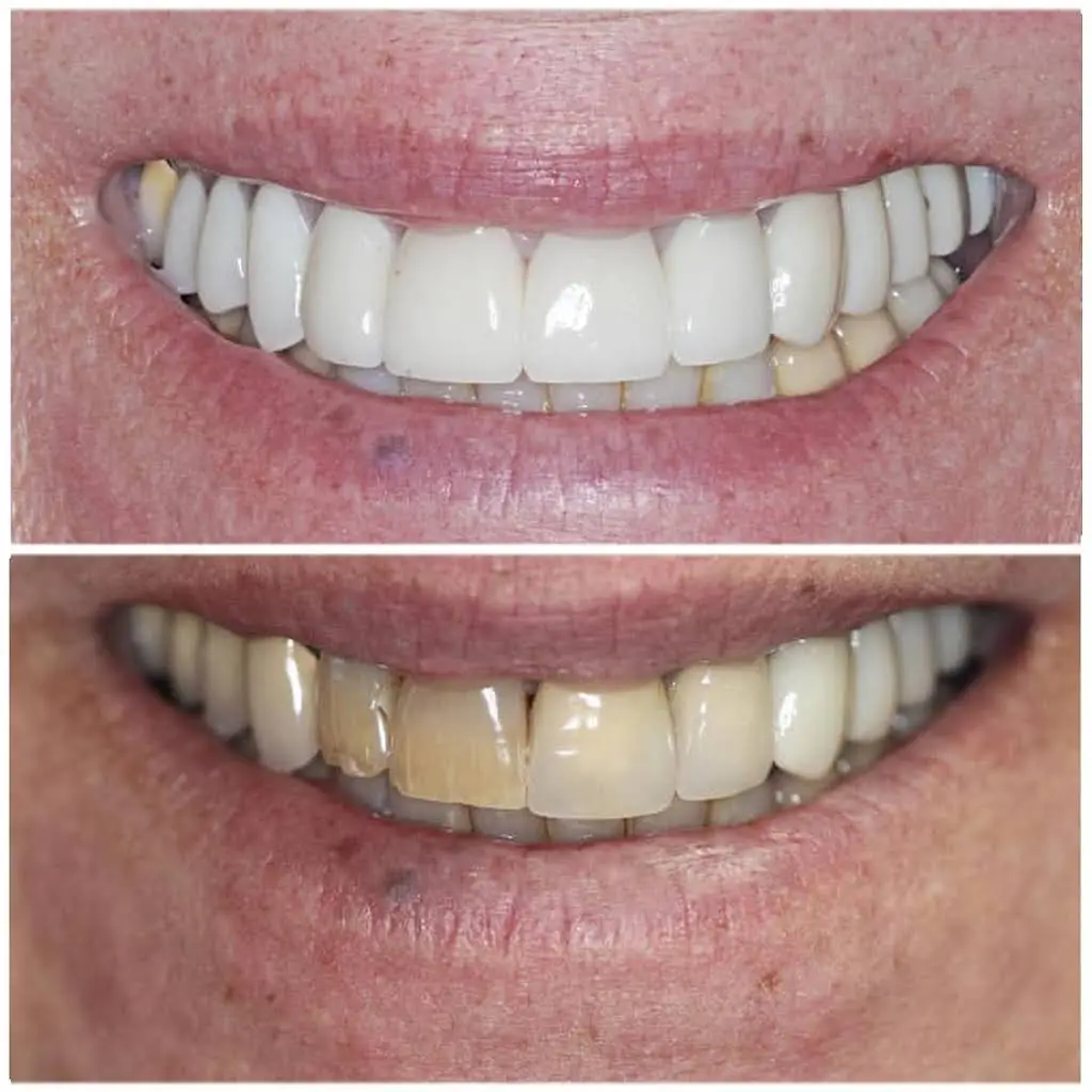 Golden Mile Dental