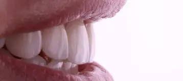Anchor Dental