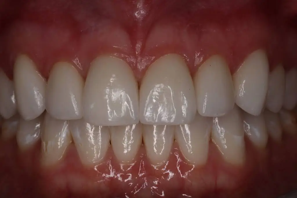 Anchor Dental