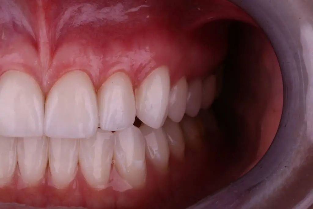 Anchor Dental