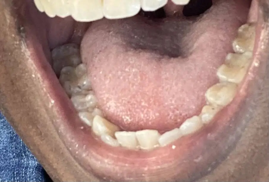 Hudec Dental