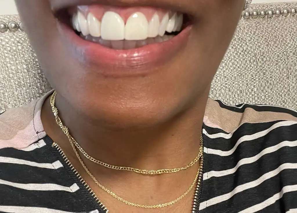 Hudec Dental