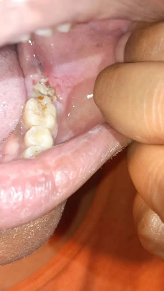 Hudec Dental