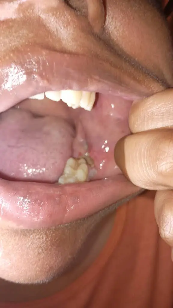 Hudec Dental