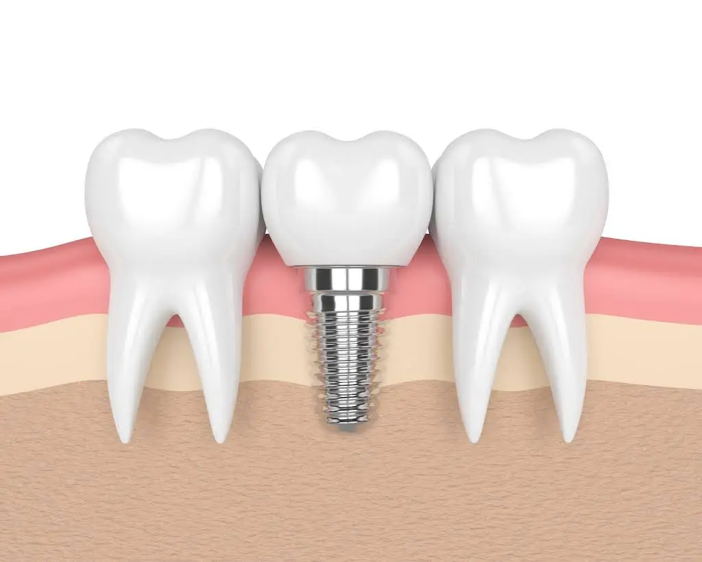 Dr. Steven Ingber General & Implant Dentistry
