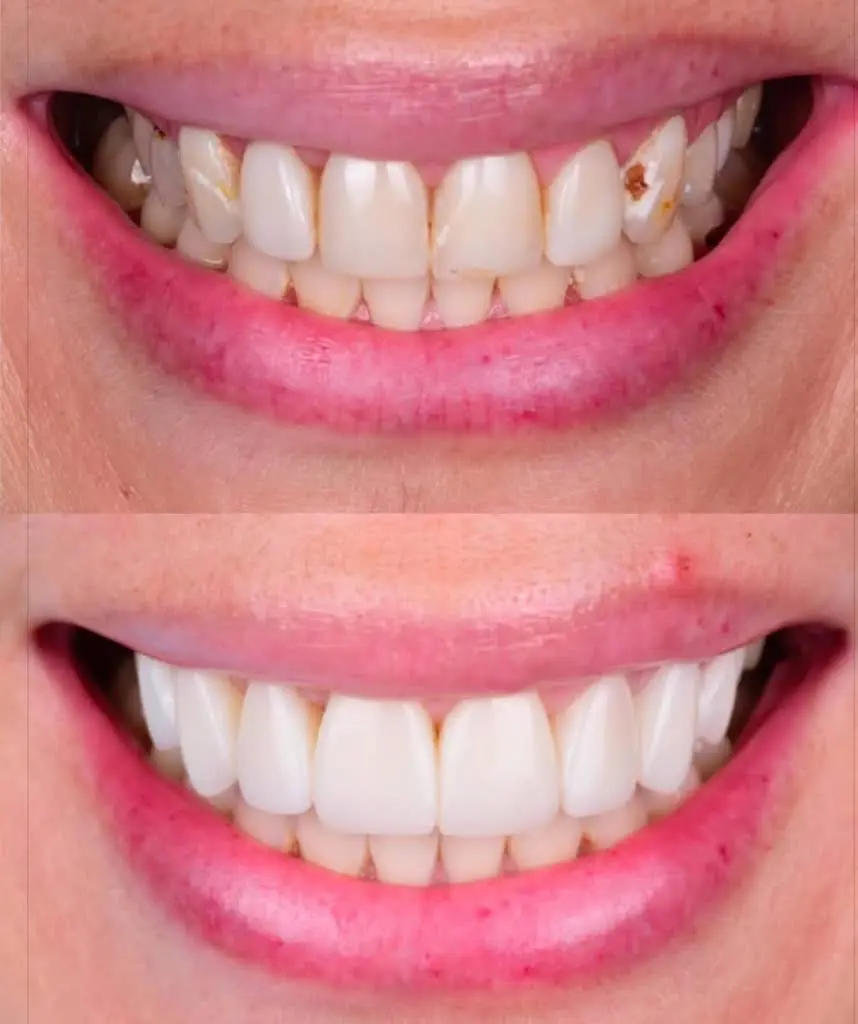 The Smile Team Family Dentistry