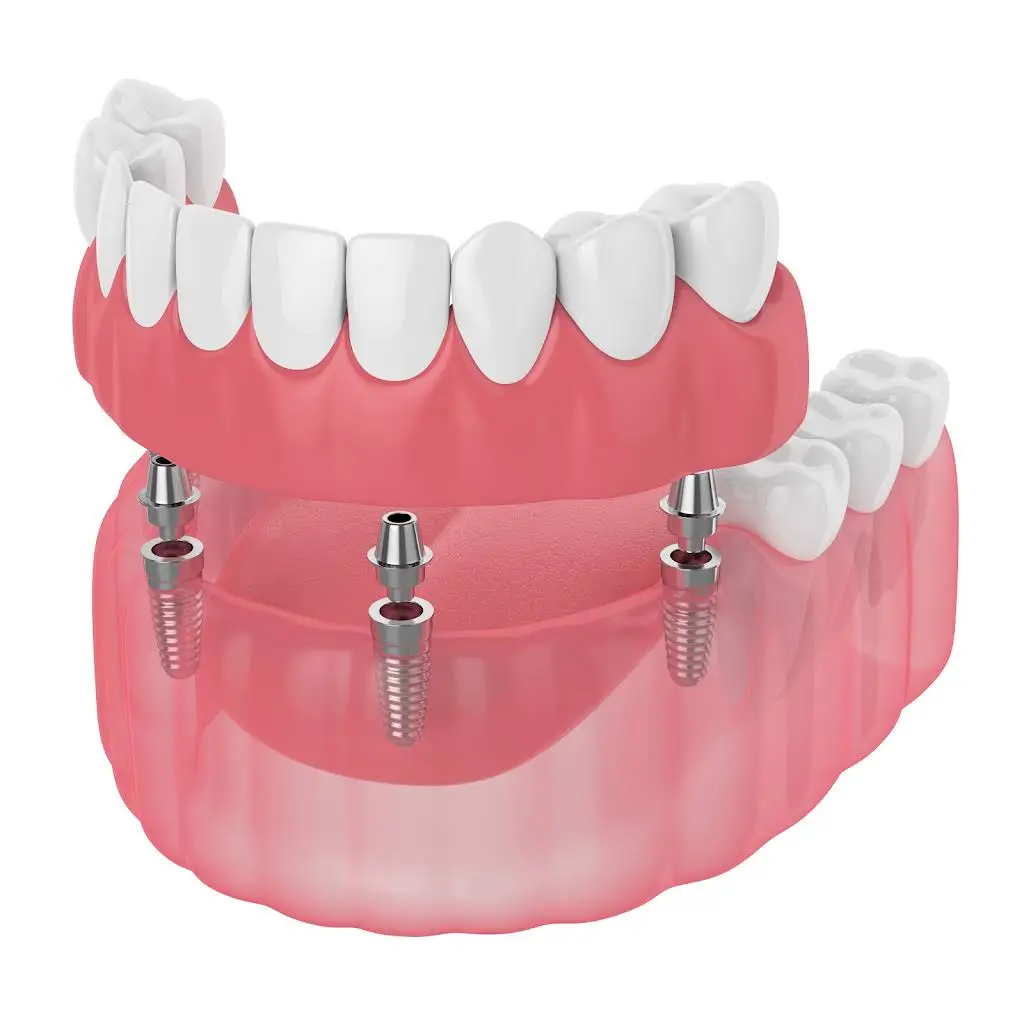 Carlton Dental