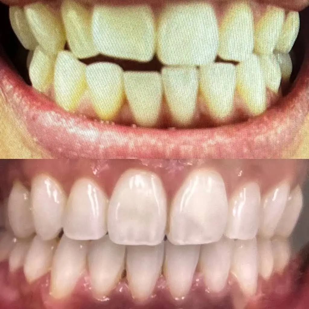 Benadent Dental Services