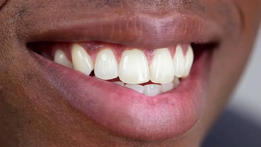VS Dental By Everbright Smiles
