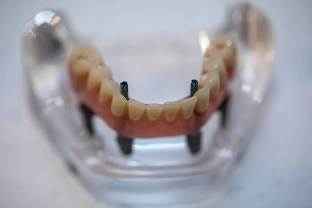 Bluegrass Dentistry