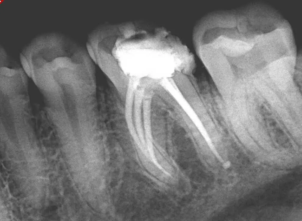 Endodontic Center of Lexington