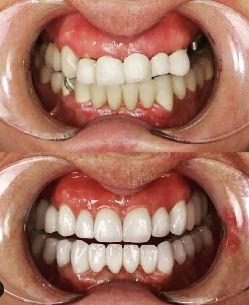 ThoroughDent Smiles