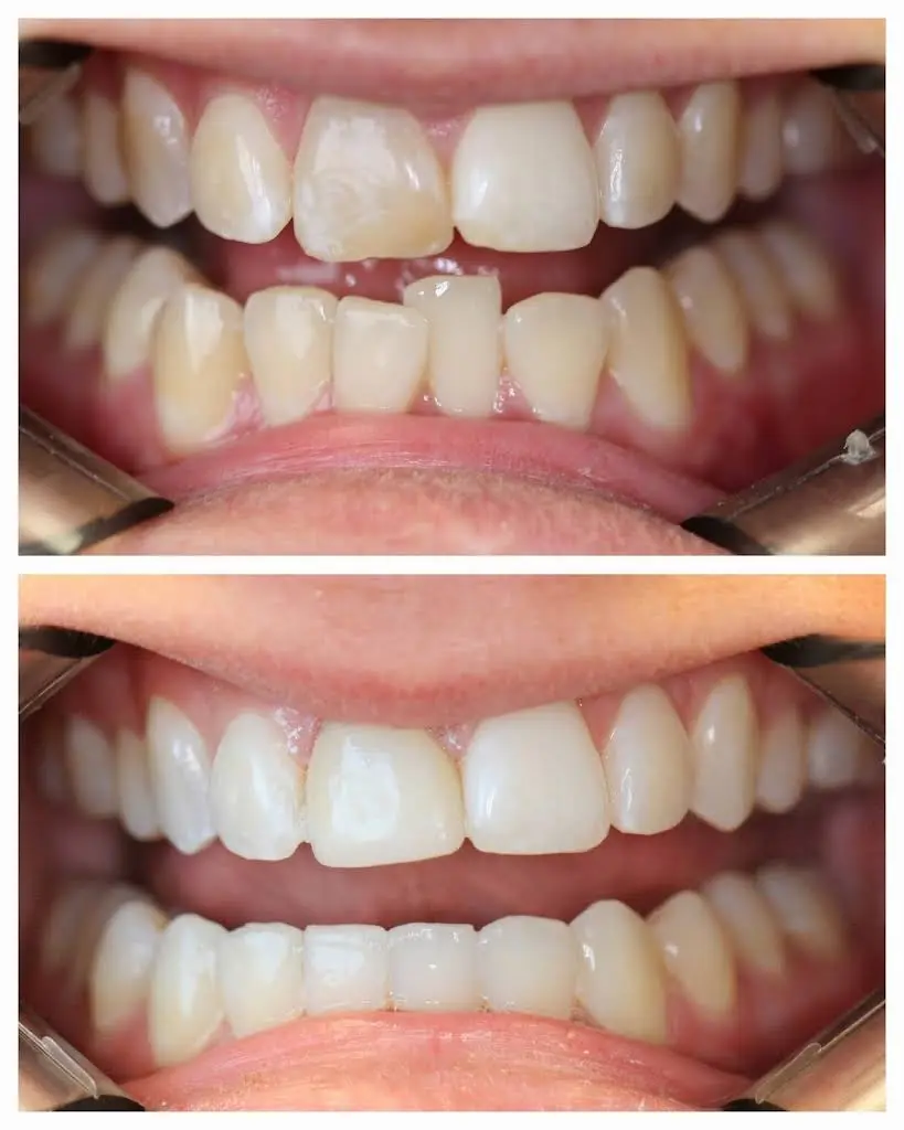 Hughes Family Dentistry