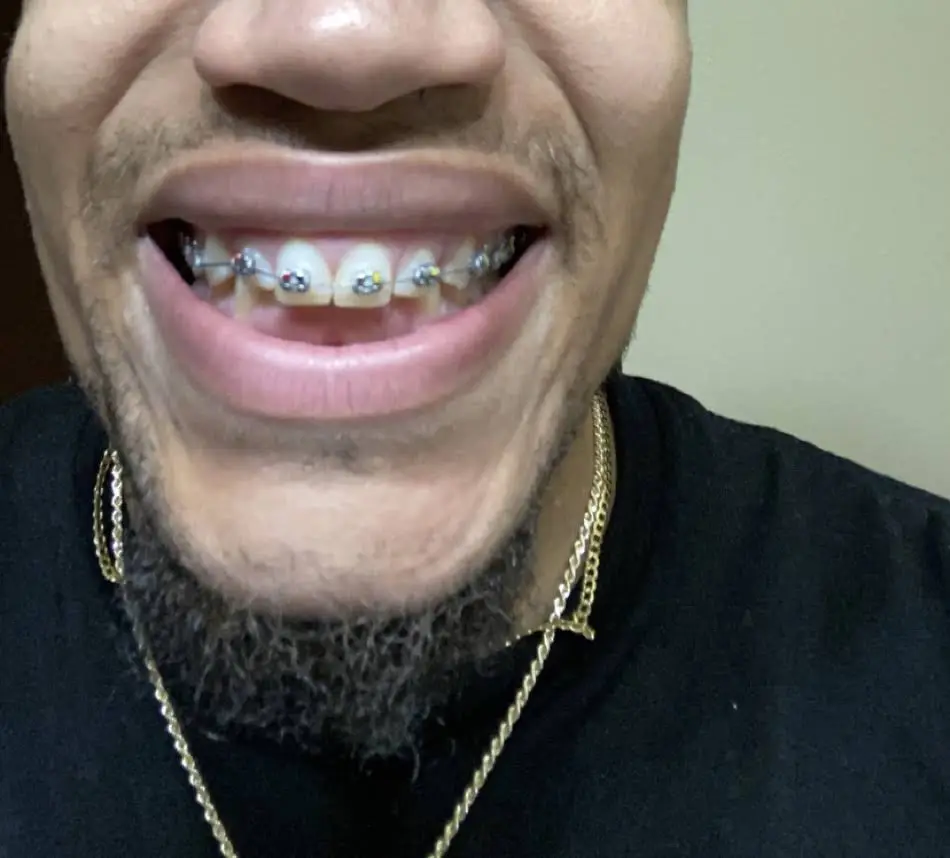 Home of the Perfect Smile