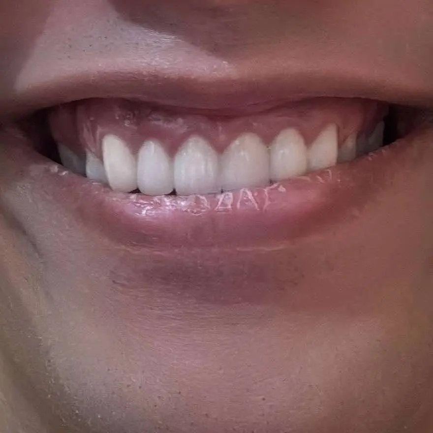 My Morning Smile Dental