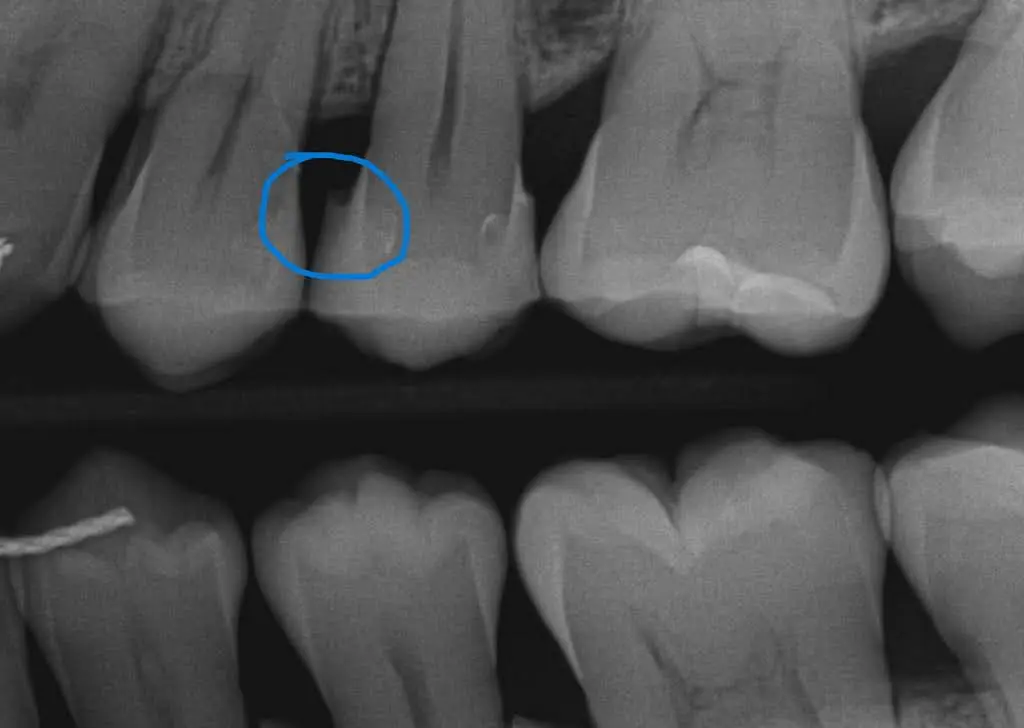 Adelaide Dental