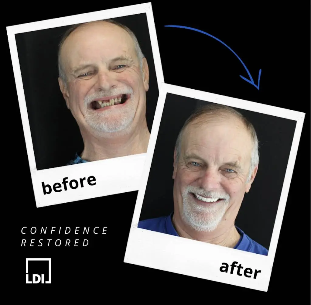 Louisville Dentures and Implants
