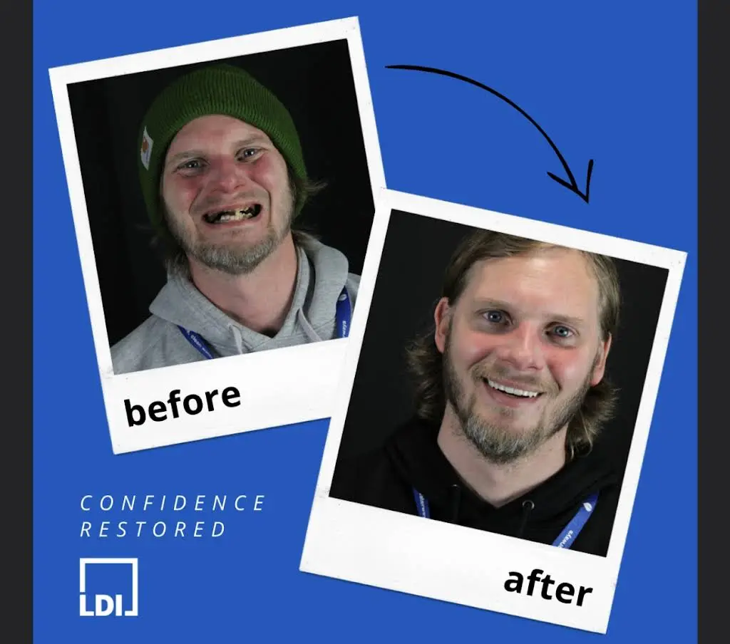 Louisville Dentures and Implants