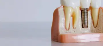 South Louisville Oral Surgery