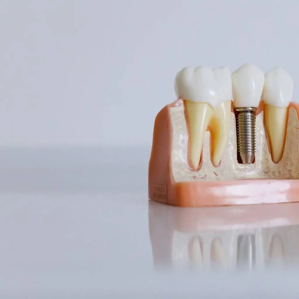 South Louisville Oral Surgery