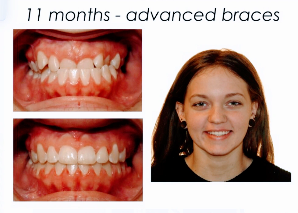 Henn Orthodontics