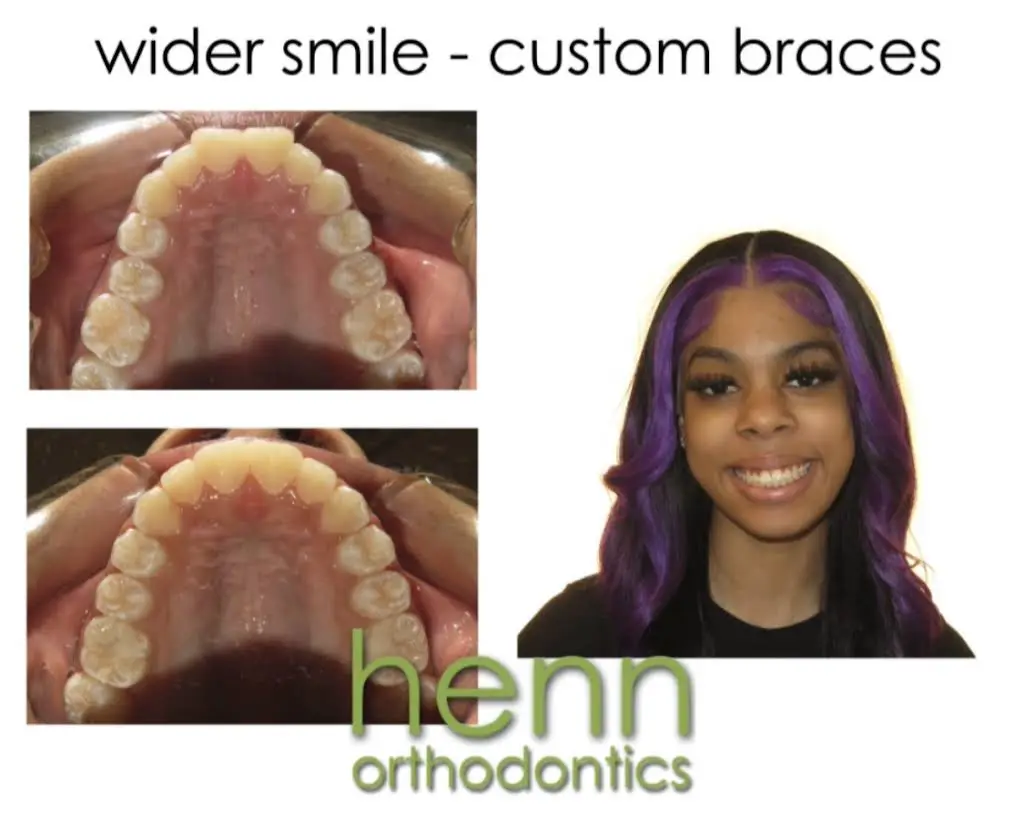 Henn Orthodontics