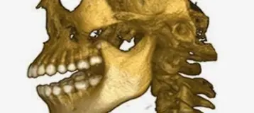 Oral & Maxillofacial Surgery Associates, Inc.