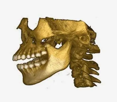Oral & Maxillofacial Surgery Associates, Inc.