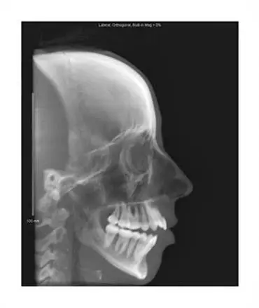 Oral & Maxillofacial Surgery Associates, Inc.