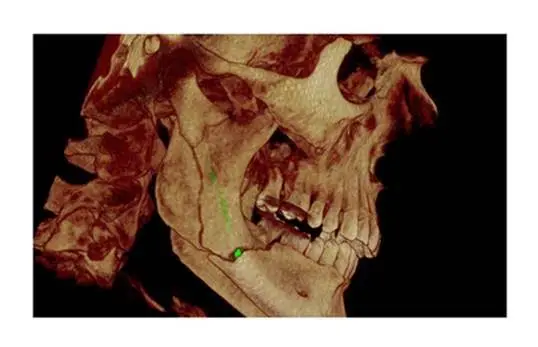 Oral & Maxillofacial Surgery Associates, Inc.