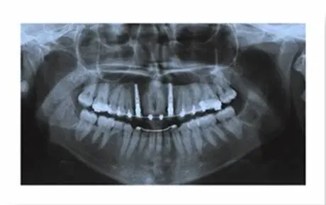 Oral & Maxillofacial Surgery Associates, Inc.