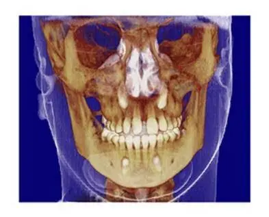 Oral & Maxillofacial Surgery Associates, Inc.