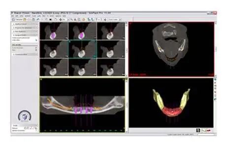 Oral & Maxillofacial Surgery Associates, Inc.