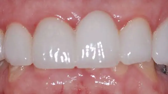 Allure Dental