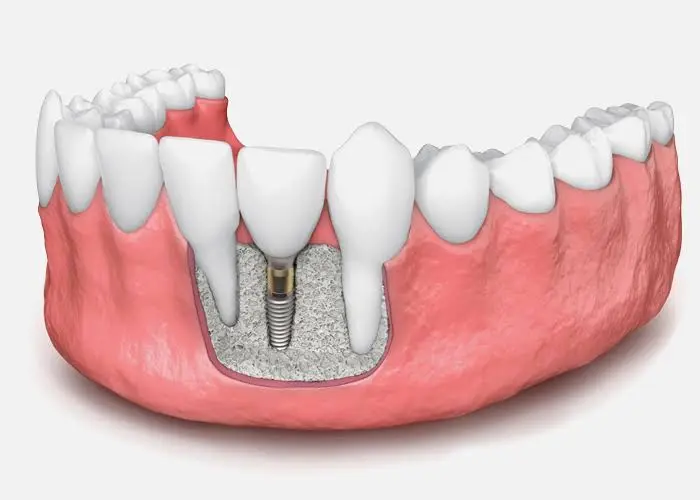 Allure Dental