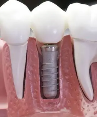 Advantage Dental & Dentures