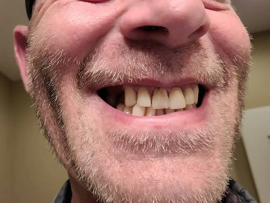 Advantage Dental & Dentures