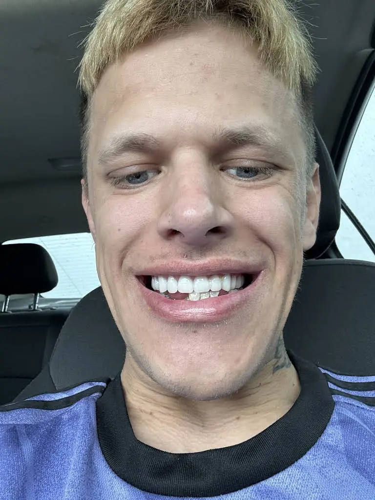 Affordable Dentures & Implants