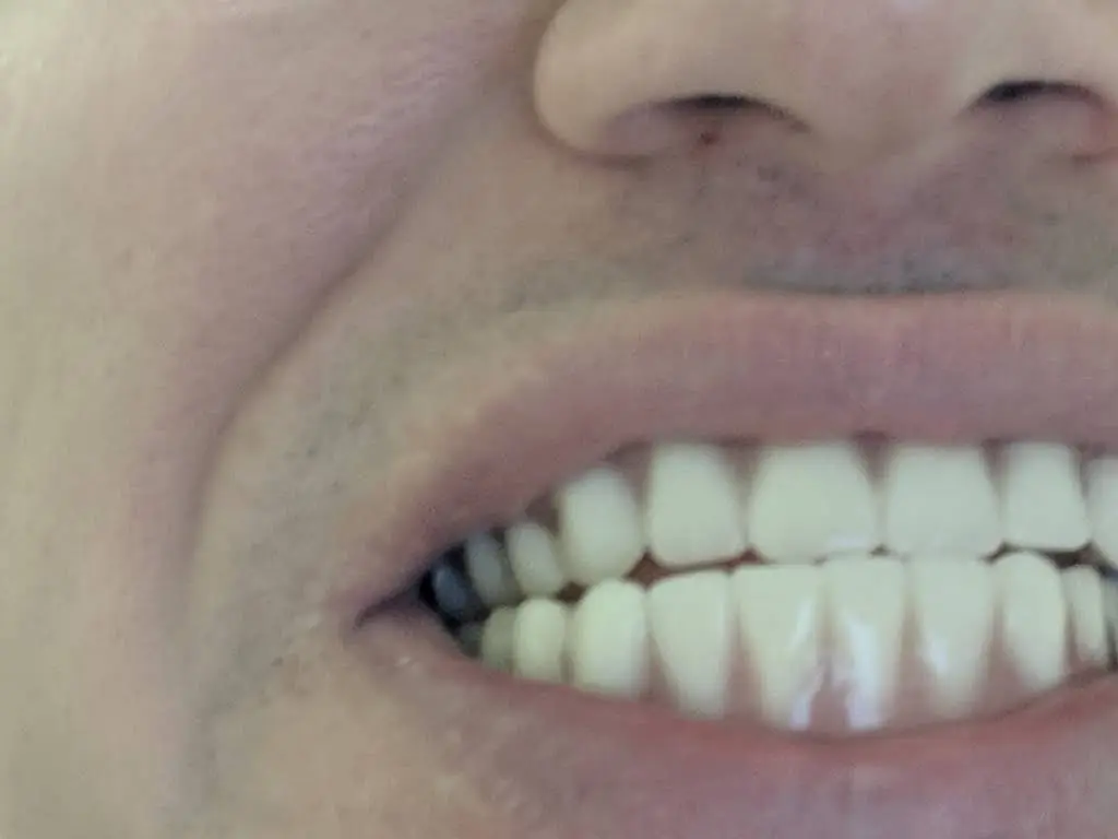 Aspen Dental