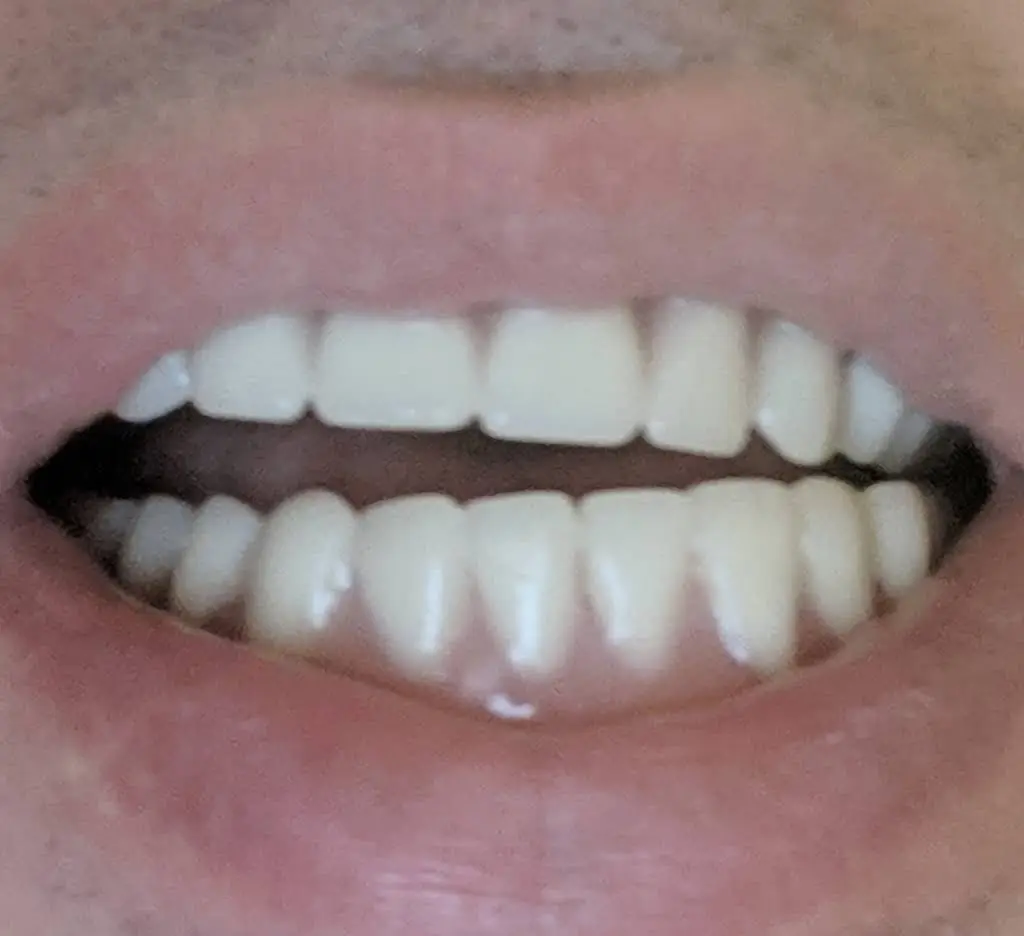 Aspen Dental