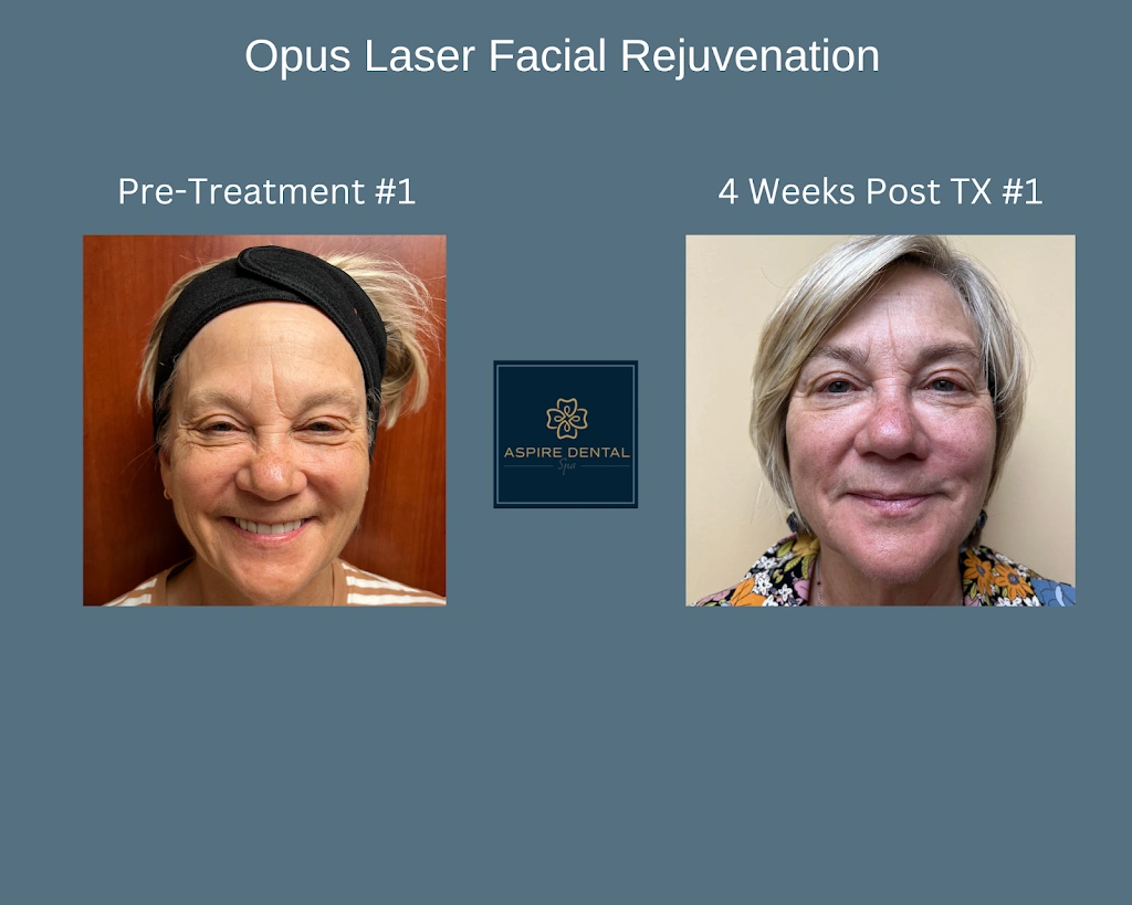 Aspire Dental Spa